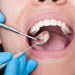 10 Tips for Proper Dental Care