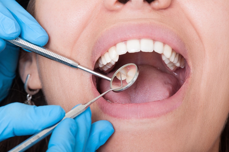 10 Tips for Proper Dental Care